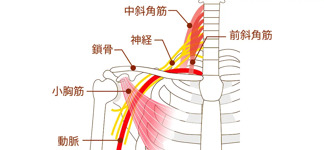 胸郭出口症候群