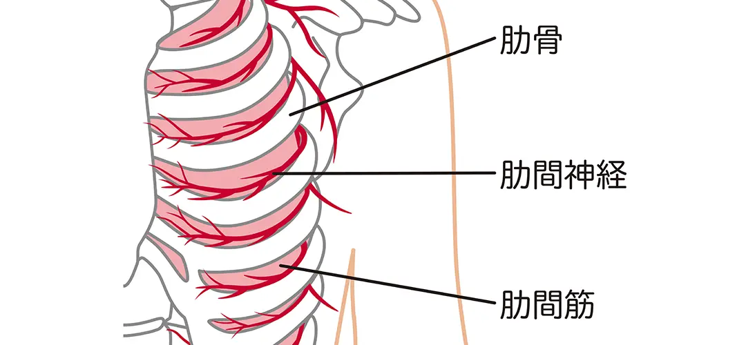 肋間神経痛